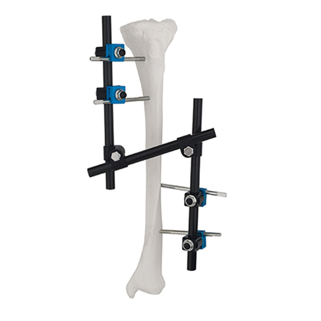 Orthopedic AO Dedign Combinational Z Type (enhancement Mode)External ...